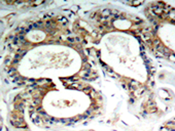 兔抗PTPN11 (Phospho-Tyr542)多克隆抗体