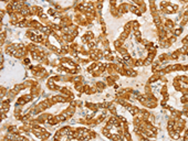 兔抗PTPN22多克隆抗体