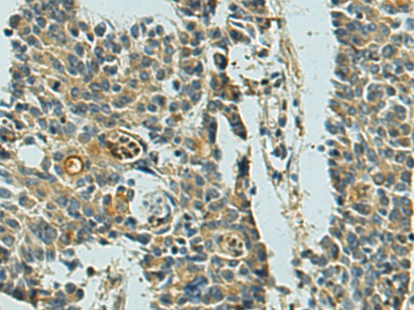 兔抗MRPL48多克隆抗体