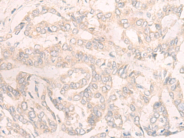 兔抗ENOSF1多克隆抗体