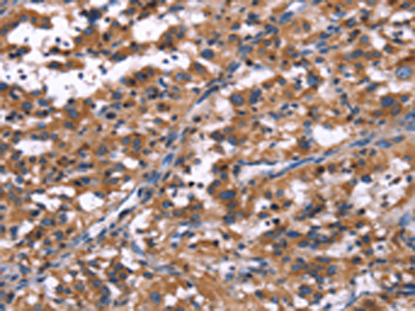 兔抗R3HCC1L多克隆抗体