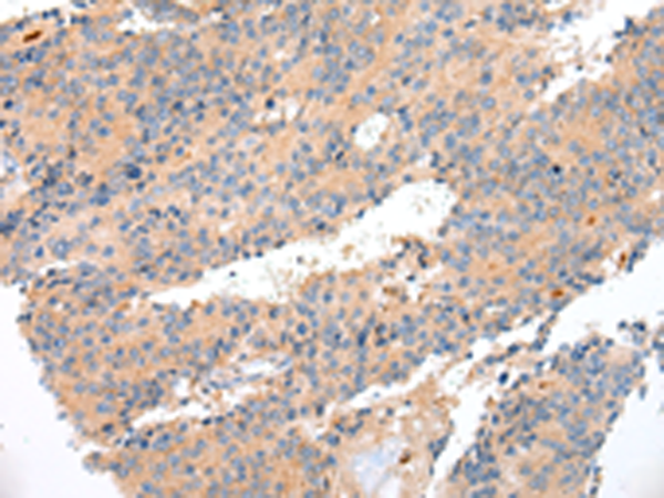 兔抗ENPP1多克隆抗体
