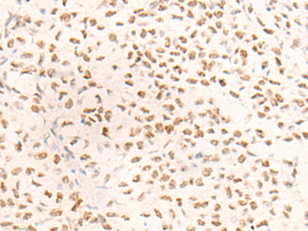 兔抗MSH2多克隆抗体