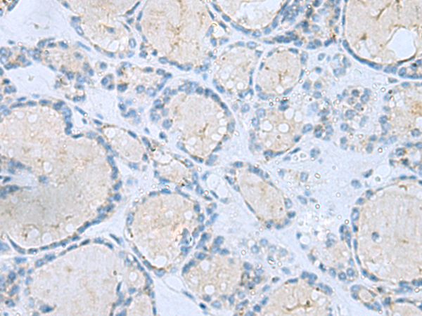 兔抗MSI2多克隆抗体