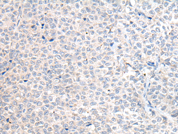 兔抗MT-ND5多克隆抗体