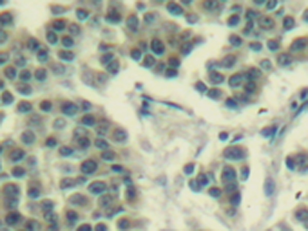 兔抗ERBB3 (phospho-Tyr1328)多克隆抗体