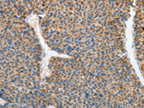 兔抗RCAN1多克隆抗体 