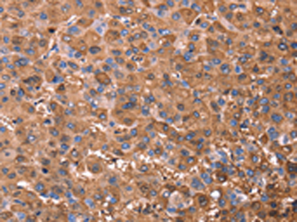 兔抗ERN2多克隆抗体