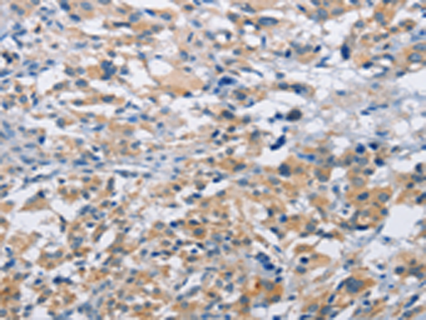 兔抗MTMR4多克隆抗体