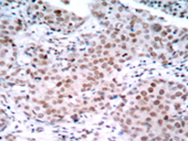 兔抗ESR1 (Phospho-Ser104)多克隆抗体