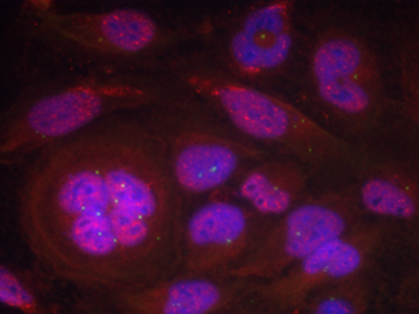 兔抗RELA (Phospho-Ser276) 多克隆抗体