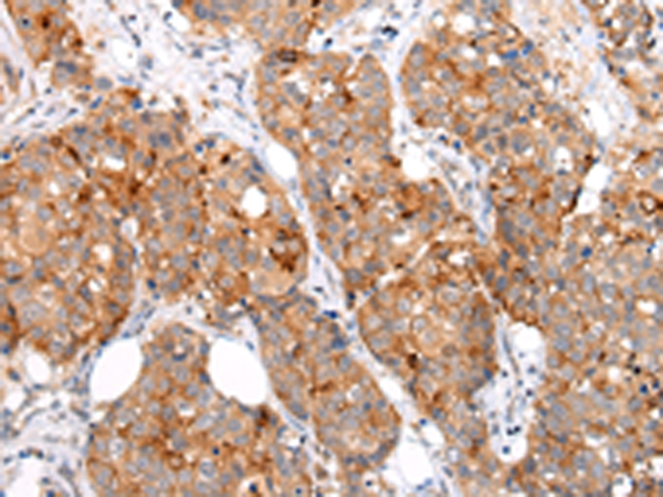 兔抗MUC1(CT)多克隆抗体 