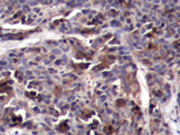 兔抗RELA (Phospho-Thr505)多克隆抗体 