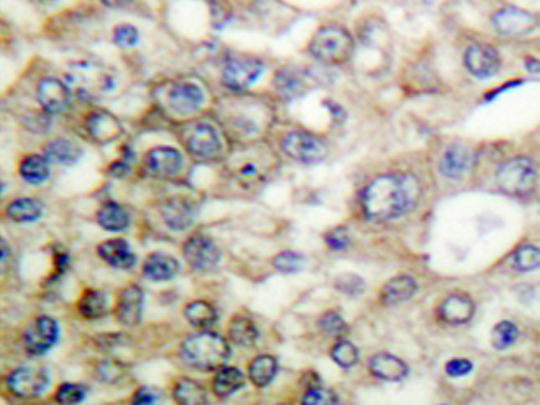 兔抗MUC1(Phospho-Tyr1229)多克隆抗体