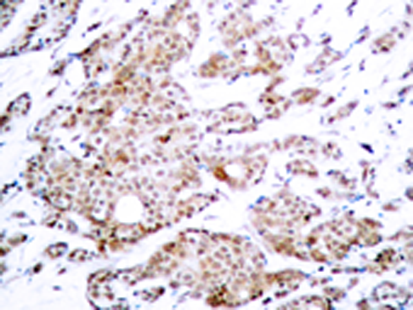 兔抗MYC(Phospho-Thr58)多克隆抗体