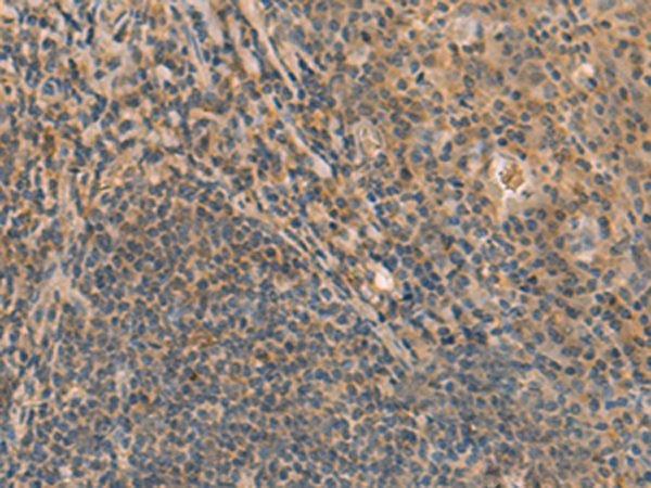 兔抗FAM186B多克隆抗体