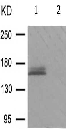 兔抗FANCD2(Phospho-Ser222) 多克隆抗体