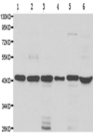 兔抗FEN1多克隆抗体