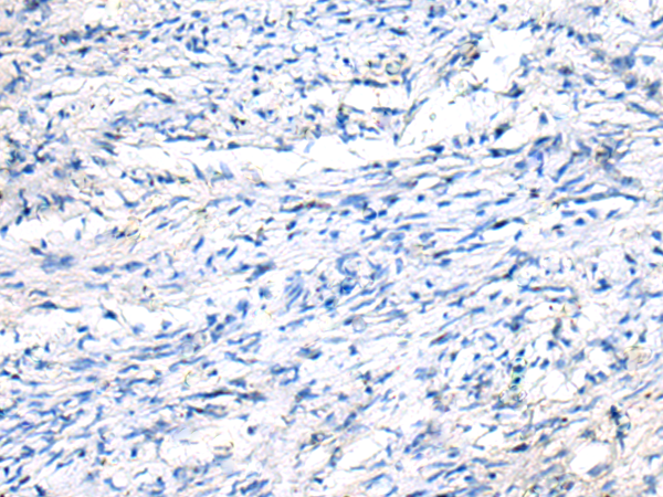兔抗FGF11多克隆抗体