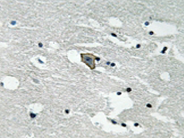 兔抗FLT1(Phospho-Tyr1048) 多克隆抗体