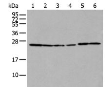 兔抗HSD17B10多克隆抗体