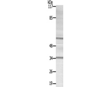 兔抗HSF1(Ab-142) 多克隆抗体