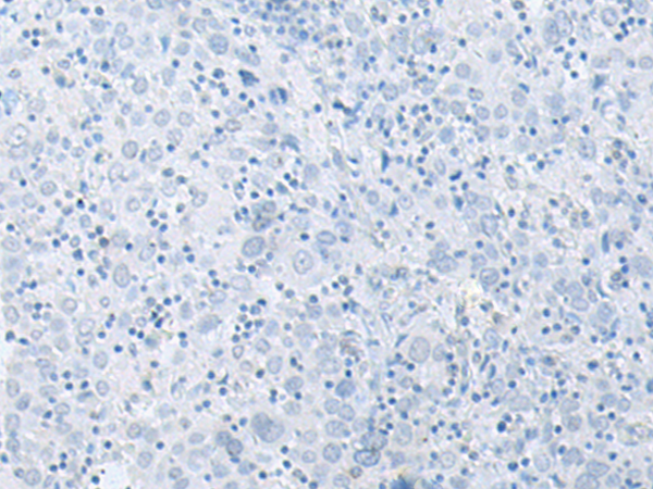 兔抗FXYD6多克隆抗体   