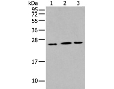 兔抗IL6多克隆抗体