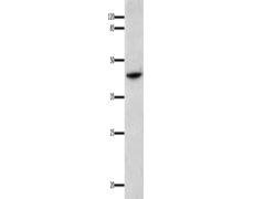 兔抗IL18BP多克隆抗体
