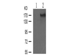 兔抗IRS1 (Phospho-Ser312)多克隆抗体