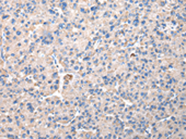 兔抗CHMP3多克隆抗体
