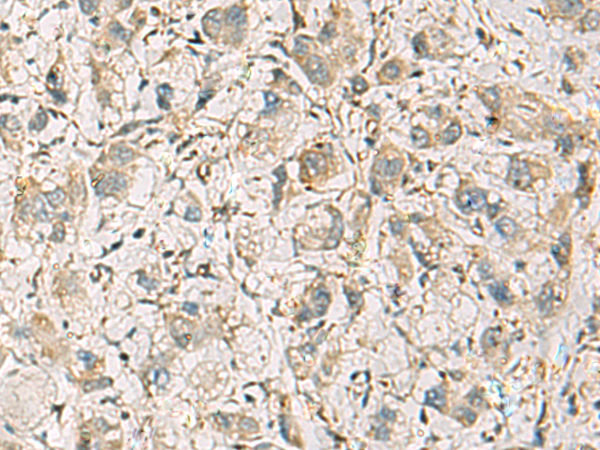 兔抗CMTM1多克隆抗体