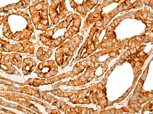 兔抗CNR1多克隆抗体