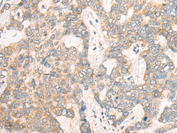 兔抗CSNK1G1多克隆抗体