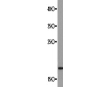 兔抗RNASE12多克隆抗体