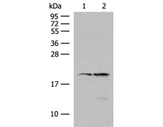 兔抗RNF5多克隆抗体