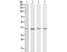 兔抗RNF113B多克隆抗体
