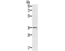 兔抗RNF144B多克隆抗体