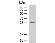 兔抗RNF208多克隆抗体