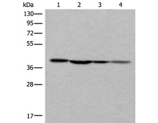 兔抗ROM1多克隆抗体