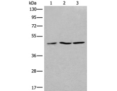 兔抗RPL3多克隆抗体