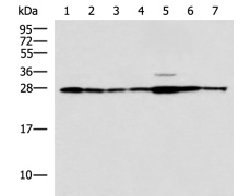 兔抗RPL10A多克隆抗体