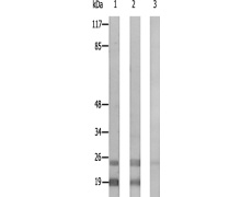 兔抗RPL12多克隆抗体