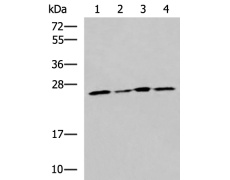 兔抗RPL13A多克隆抗体