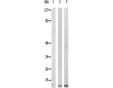 兔抗RPL30多克隆抗体