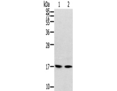 兔抗RPLP1多克隆抗体