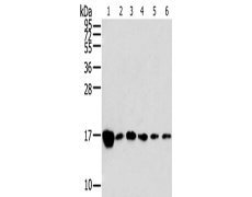 兔抗RPLP2多克隆抗体