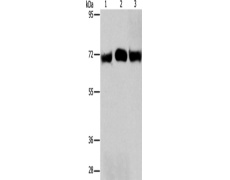 兔抗RPN1多克隆抗体