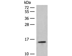 兔抗RPP14多克隆抗体