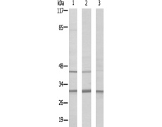 兔抗RPS4Y1多克隆抗体